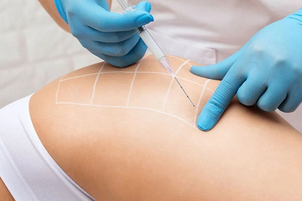 18g Cannula for Buttocks