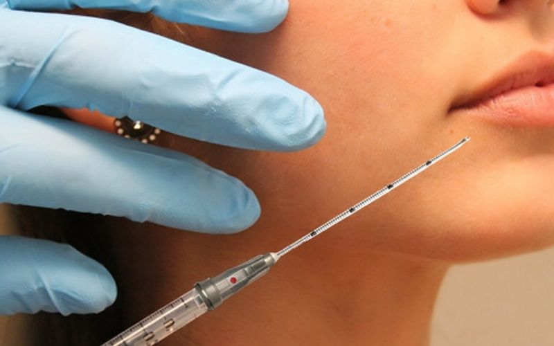 22G Cannula for Filling Nasolabial Folds