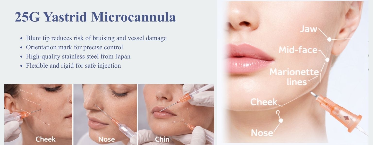 25G Yastrid Microcannula Application