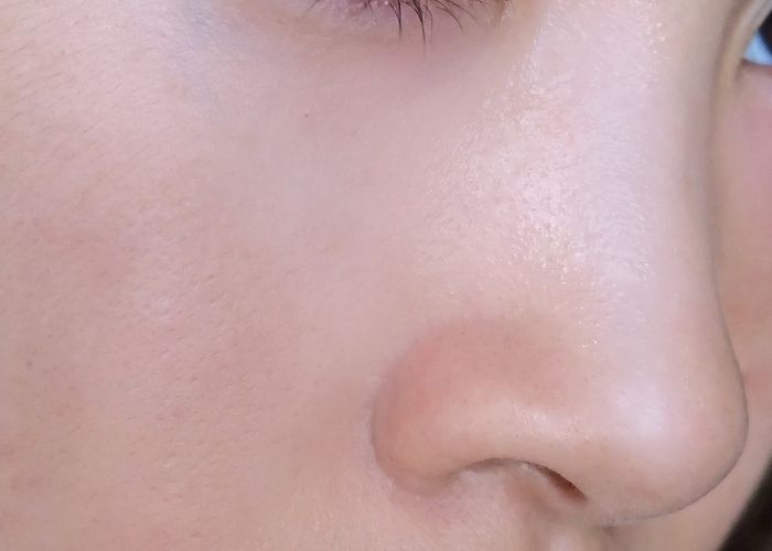 After using the Precision Beauty Facial Steamer