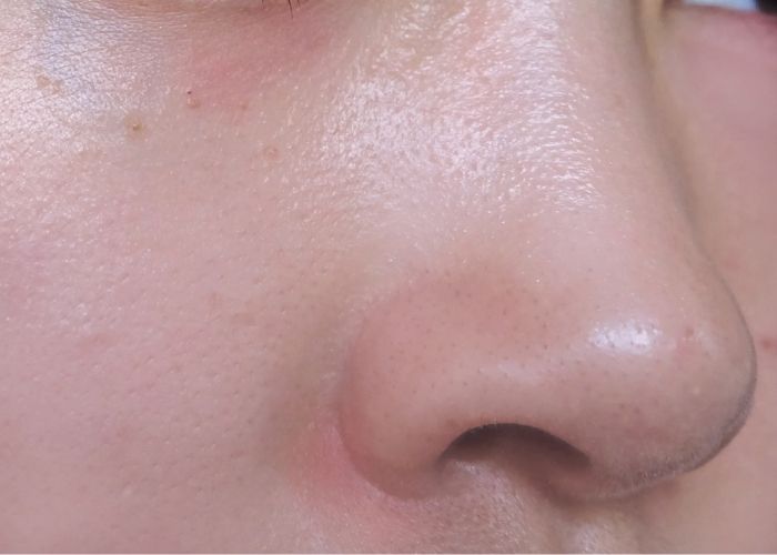 Before using the Precision Beauty Facial Steamer