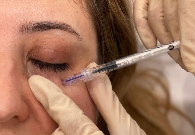 Crystal 3 Pin Multi Needle Under Eye