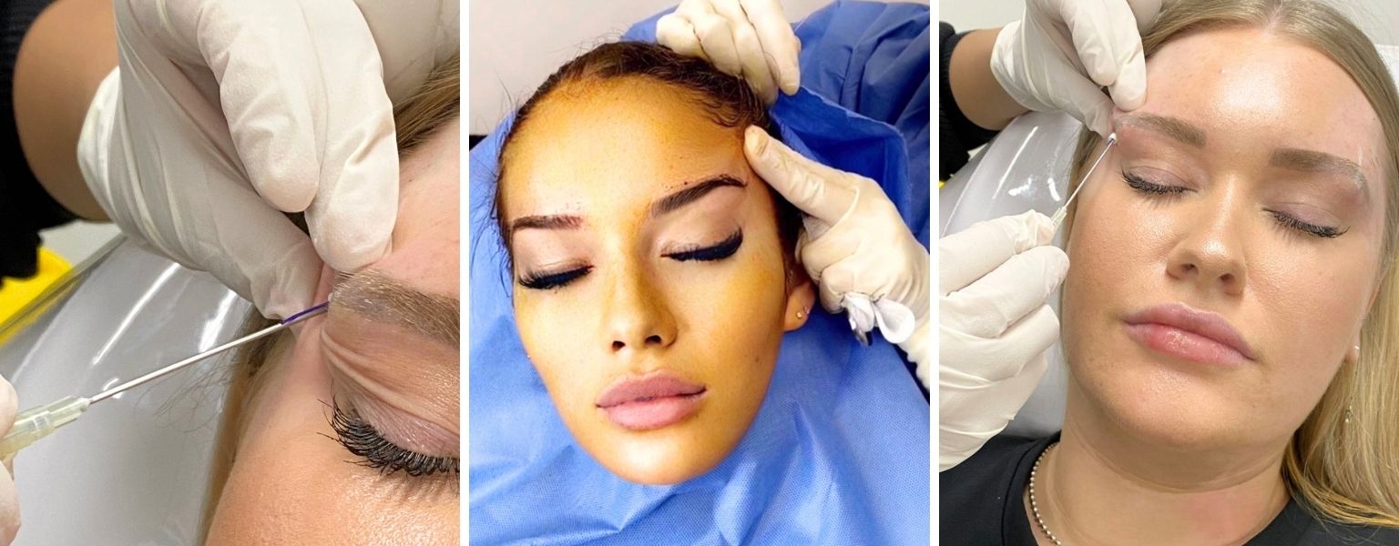 Fox Eye Threads Indications & Treatment Areas