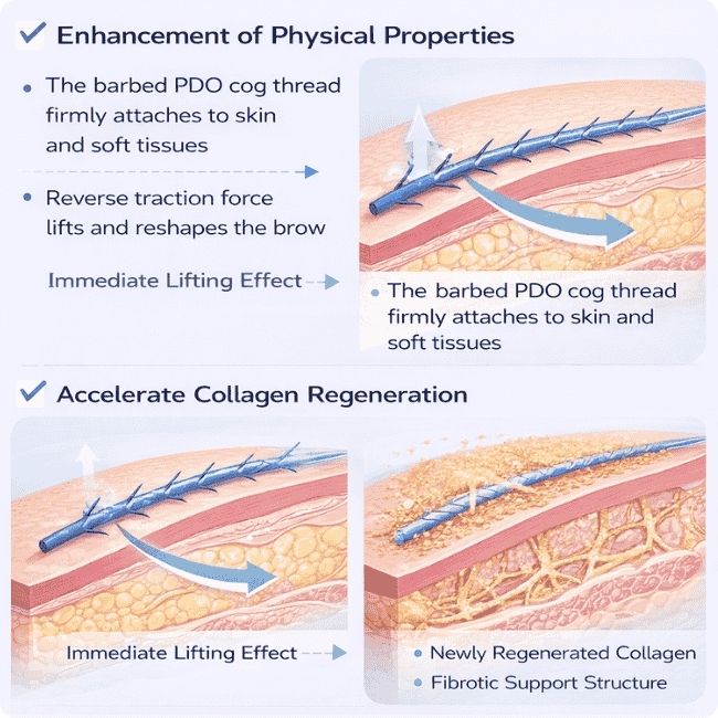 How Do PDO Eyebrow Lift Threads Work