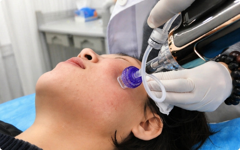 Hydration Treatments 16 Pin Needle