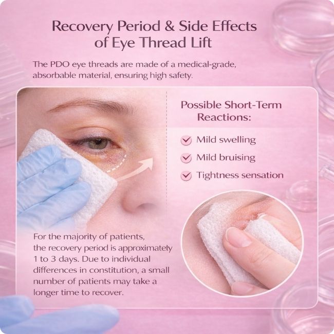 Recovery Period & Side Effects of Eye Thread Lift