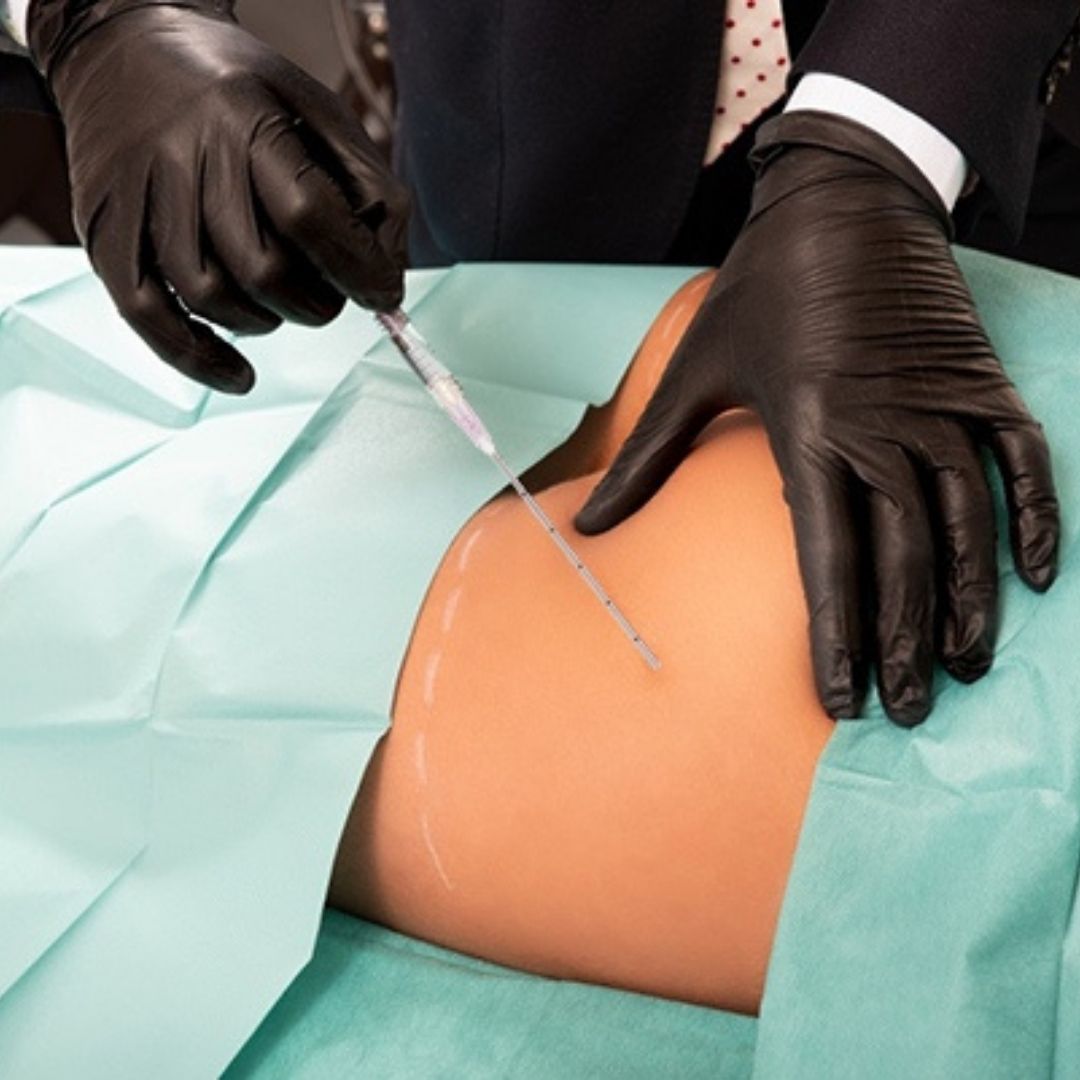 Yastrid 18g Cannula Application