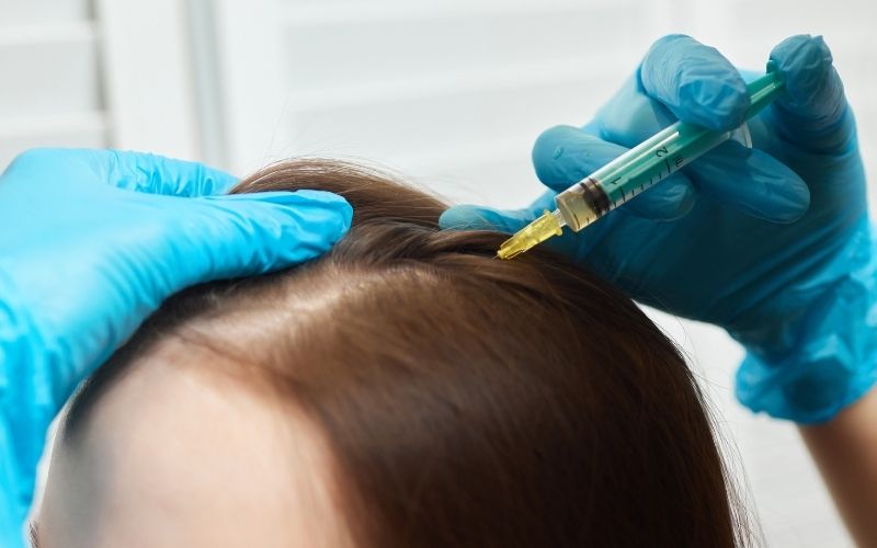 Yastrid 30Gauge Needle for Scalp injection