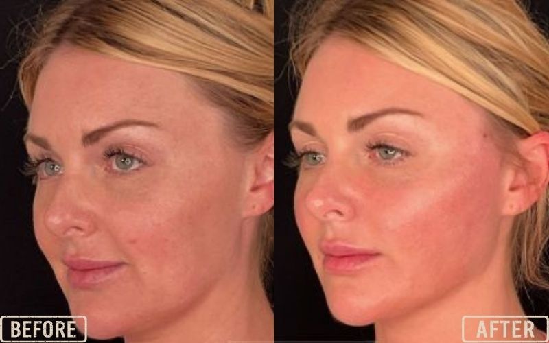 <p style="text-align: center;"><strong>Cog Threads for Face</strong></p>