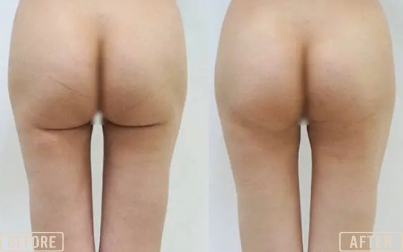 <p style="text-align: center;"><strong>Cog Threads for Hips</strong></p>