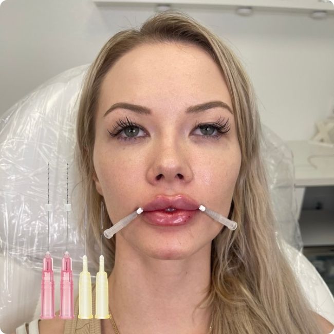 Yastrid Lip Threads Specifications
