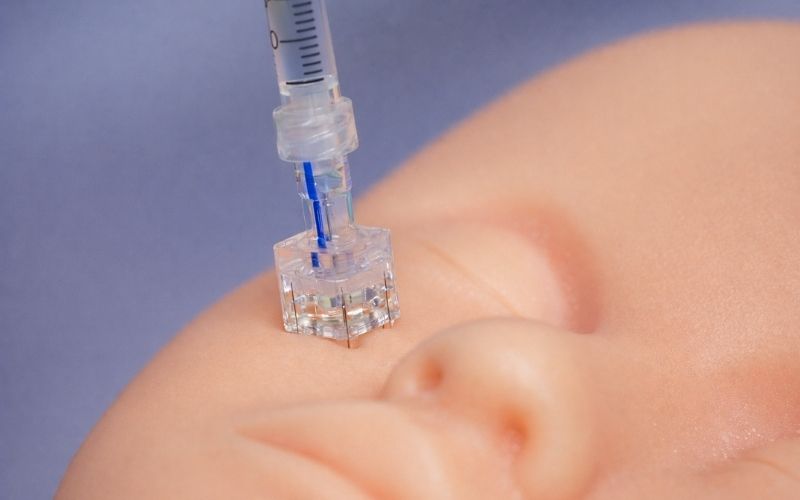Yastrid Multi Injector Needles 4Pin for Nasolabial Folds
