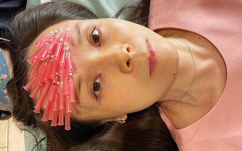 <p style="text-align: center;"><strong>PDO Mono Threads Forehead</strong></p>