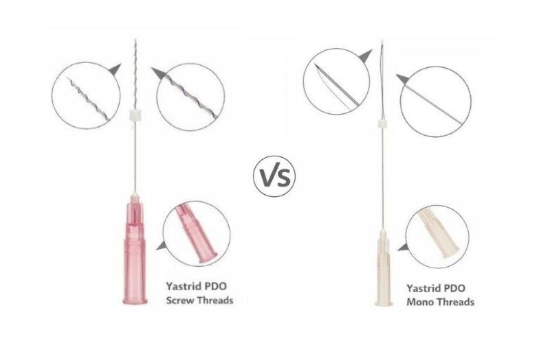 Yastrid Screw Threads vs. Mono Threads