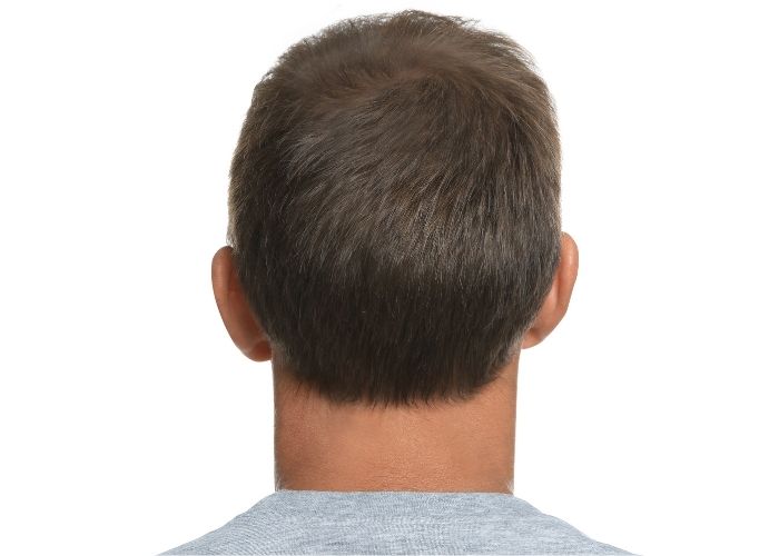 laser hair growth cap after